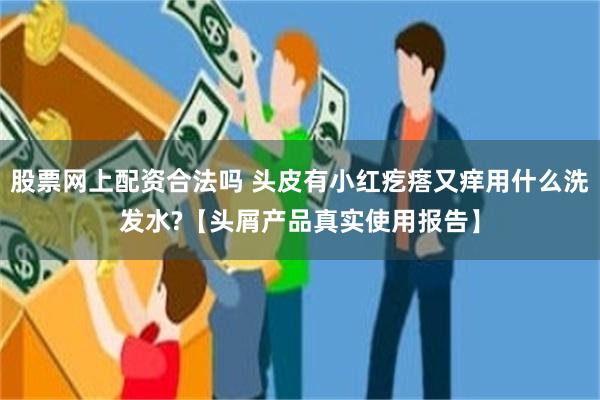 股票网上配资合法吗 头皮有小红疙瘩又痒用什么洗发水?【头屑产品真实使用报告】